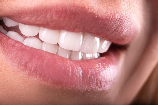 Reasons To Consider A Smile Makeover